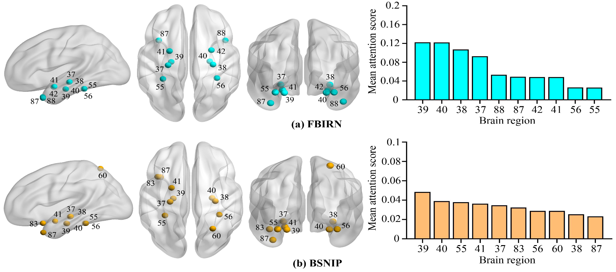 Visualization of top 10 most discriminative brain regions